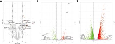 Elucidating the Molecular Mechanism of Ischemic Stroke Using Integrated Analysis of miRNA, mRNA, and lncRNA Expression Profiles
